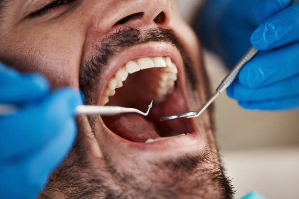 Best Dentist for Tooth Abscess  in Lincoln Village, CA